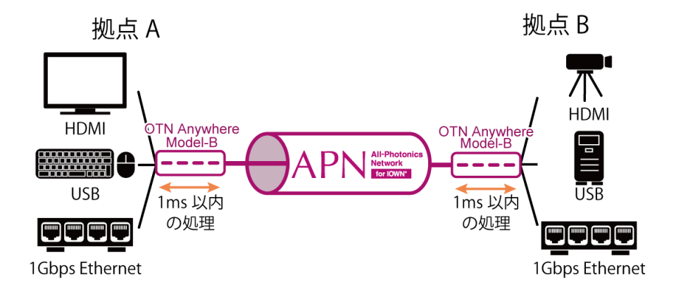 OTN Aynwhere model-B